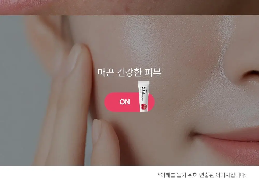 [트러블표적케어] 동아제약 아크네 프로 크림제 30ml 상세페이지 10